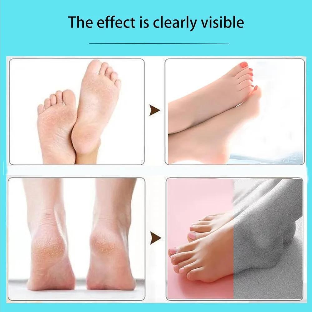 Rechargeable Electric Foot File for Effective Callus Removal